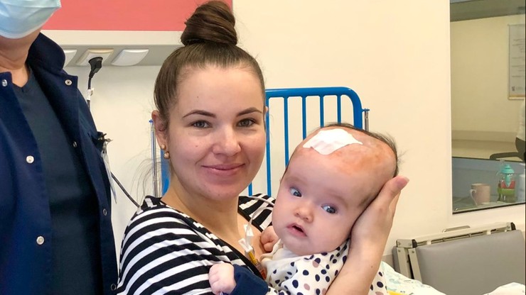 Szczecin. Neurochirurdzy zoperowali cierpiącą na wodogłowie dwumiesięczną Emilkę z Ukrainy