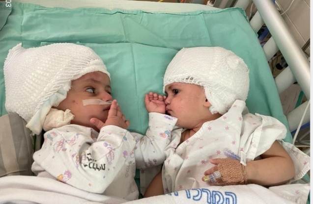 Dziewczynki są przytomne i czują się dobrze - podał izraelski szpital.