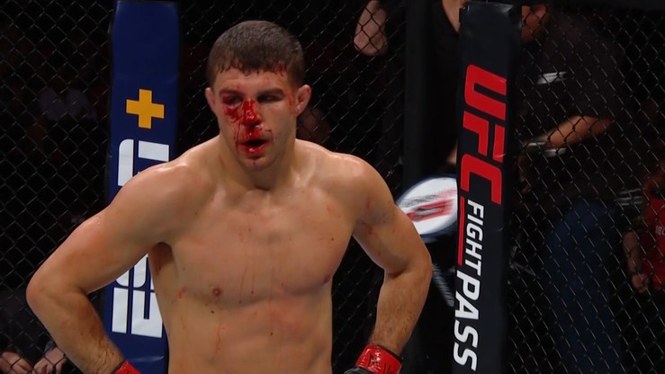 UFC: Iaquinta - Cerrone. Wyniki gali