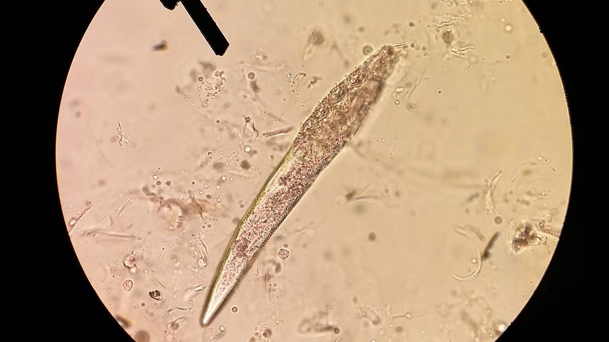 Mikroskopowy obraz pasożyta Demodex procyonis, widoczny w powiększeniu.