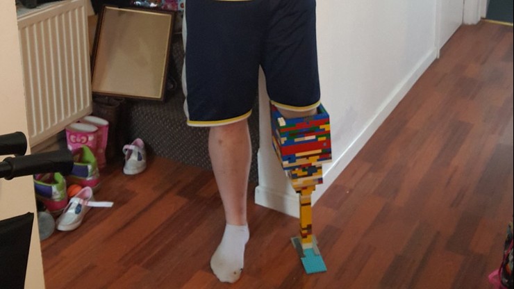 Zbudował protezę nogi z klocków Lego. Na tę prawdziwą czeka