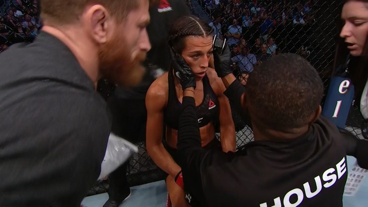 UFC: Źle wyglądający uraz Jędrzejczyk nie taki groźny. Polka bez złamania