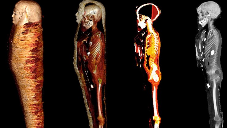 Kair: Zbadano tajemniczą mumię nastolatka. W środku 49 cennych amuletów