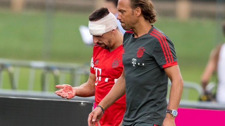 Ribery nie zauważył słupka! Potężna rana zawodnika Bayernu Monachium