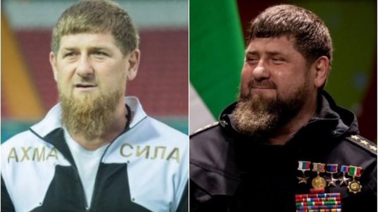 "Bild": Ramzan Kadyrow jest poważnie chory. Przyleciał do niego lekarz z ZEA