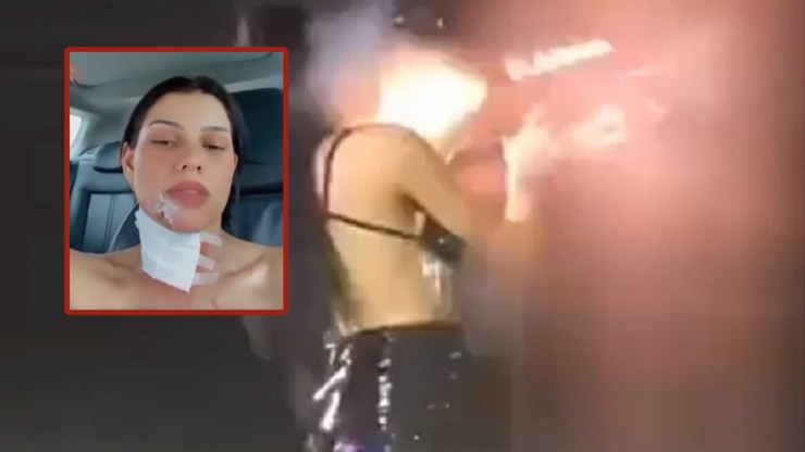 Brazylia: Wypadek podczas występu. Armatka z konfetti strzeliła prosto w twarz DJ-ki