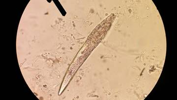 Mikroskopowy obraz pasożyta Demodex procyonis, widoczny w powiększeniu.