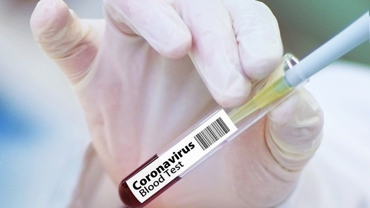 Nowe przypadki koronawirusa w Polsce. Dane ministerstwa, 23 maja