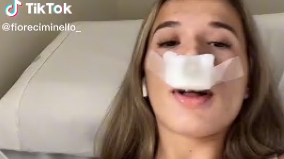 Tiktokerka Fiore Ciminello przeszła operację nosa. Stwierdziła, że robi to dla potomstwa