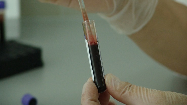 Nowa metoda wykrywania raka. Test krwi ma ujawnić chorobę zanim pojawią się jej objawy