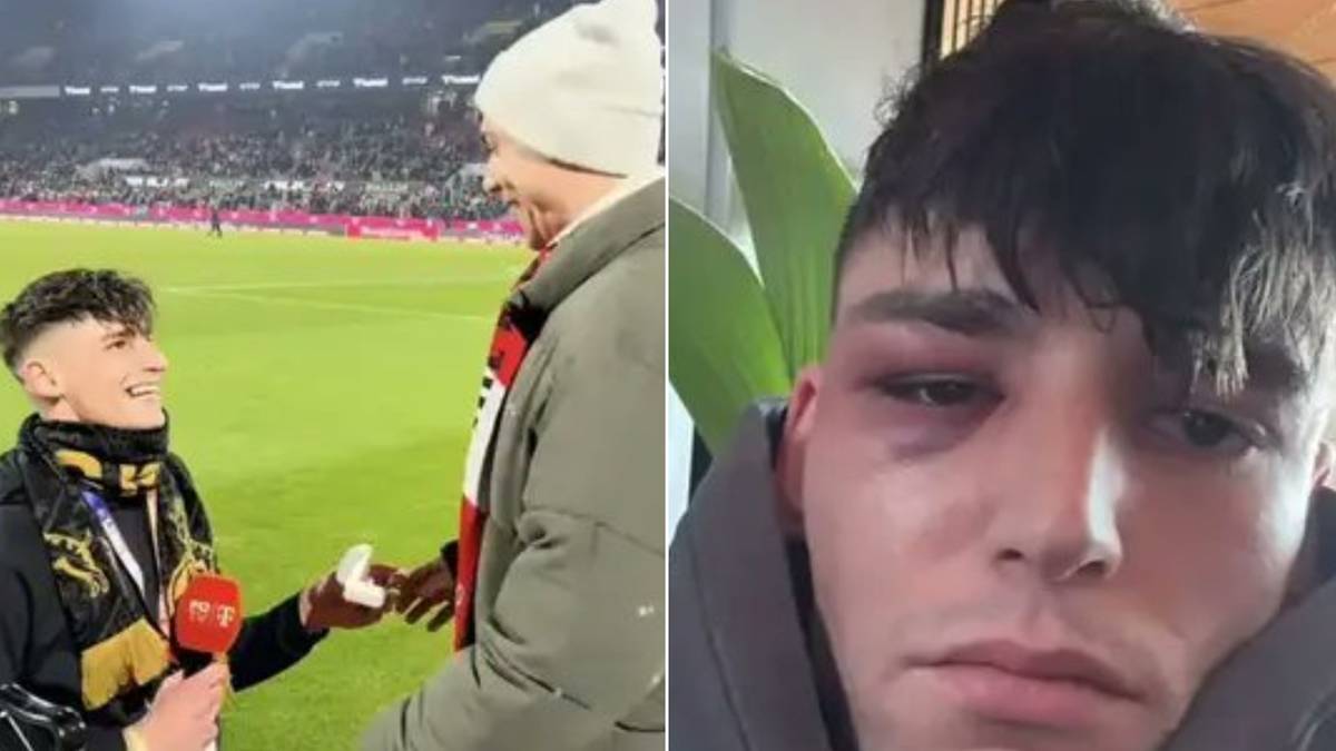 Młody mężczyzna na tle stadionu i zbliżenie na jego twarz z widocznymi obrażeniami.