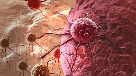 Nowa metoda walki z rakiem zmieni komórki nowotworowe w tłuszczowe