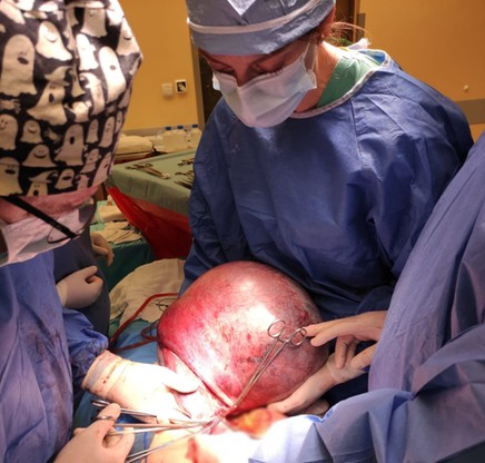 Operacja pacjentki z Krosna