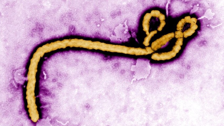 WHO: "Przypadek skrajnie niepokojący". Wirus ebola na Wybrzeżu Kości Słoniowej