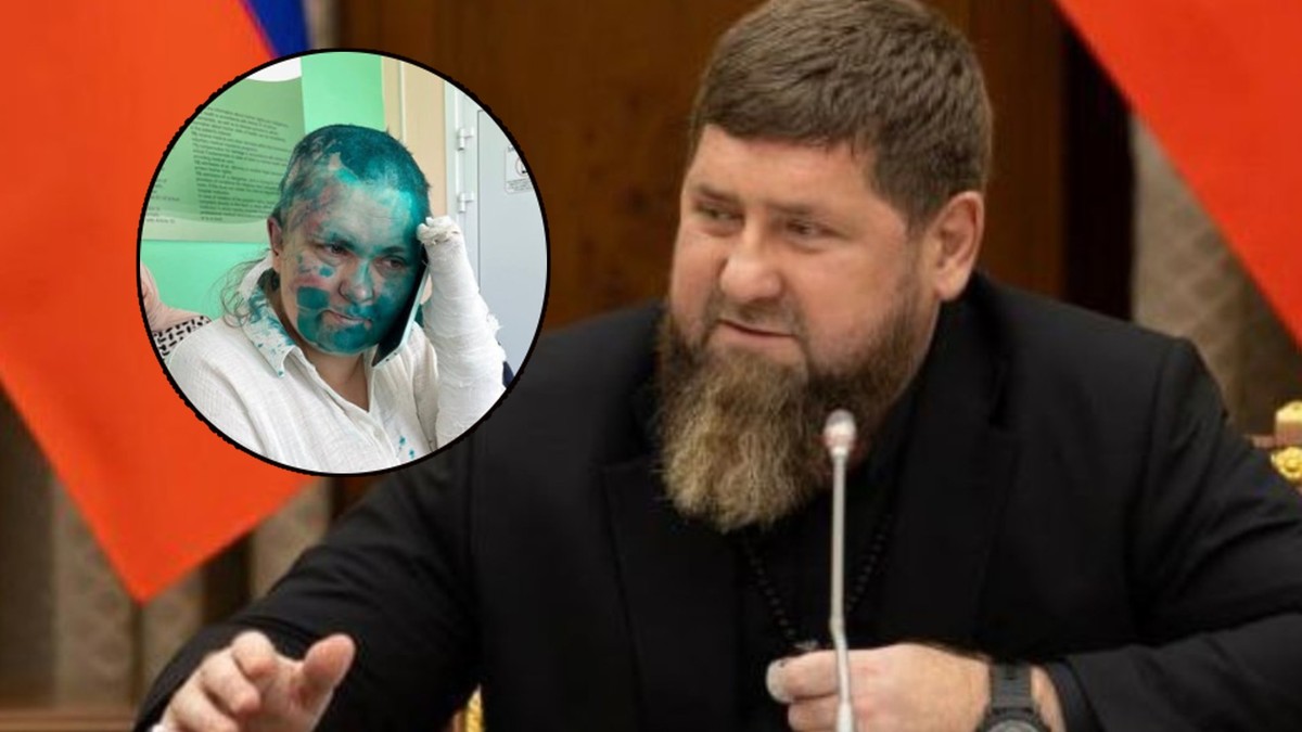 Czeczenia. Elena Milashina dotkliwie pobita. Dziennikarka opisuje zbrodnie Kadyrowa