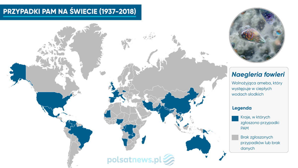 Rosnące zagrożenie amebami mózgożernymi na świecie
