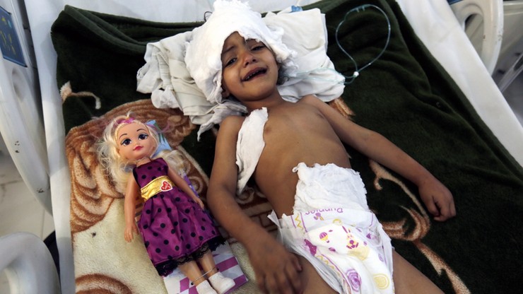 ONZ: Głód zagraża połowie populacji Jemenu