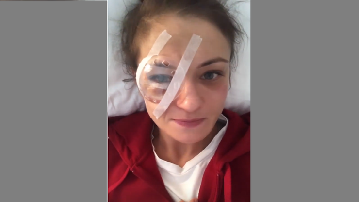 Karolina Kowalkiewicz przeszła operację oka. Powiedziała jak się czuje