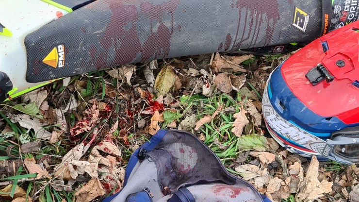 Andrychów: nożownik zaatakował motocyklistę. 21-latek w ciężkim stanie