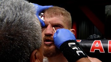 UFC: Jan Błachowicz o kontuzji oka: Niewiele brakowało i lekarz przerwałby walkę