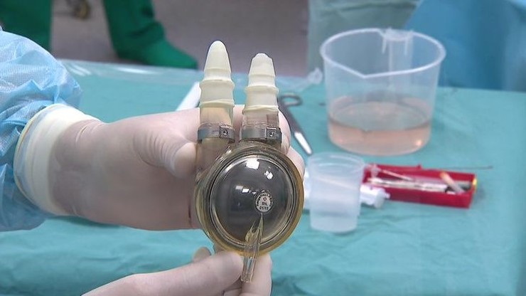 Polskie protezy serca dla dzieci pozytywnie przeszły testy. U małych pacjentów będą zastosowane za rok