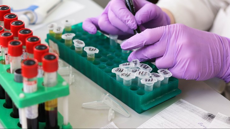 Polscy naukowcy opracowali test rozróżniający wirusy SARS-CoV-2 i grypy