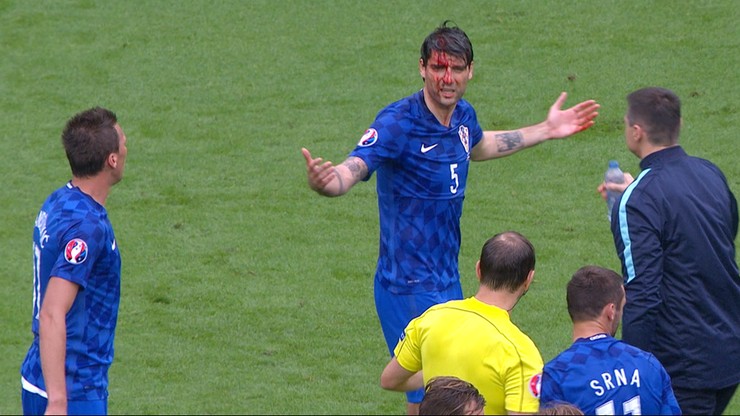EURO 2016: Krwawy Corluka! Potężny łokieć Tosuna (WIDEO)