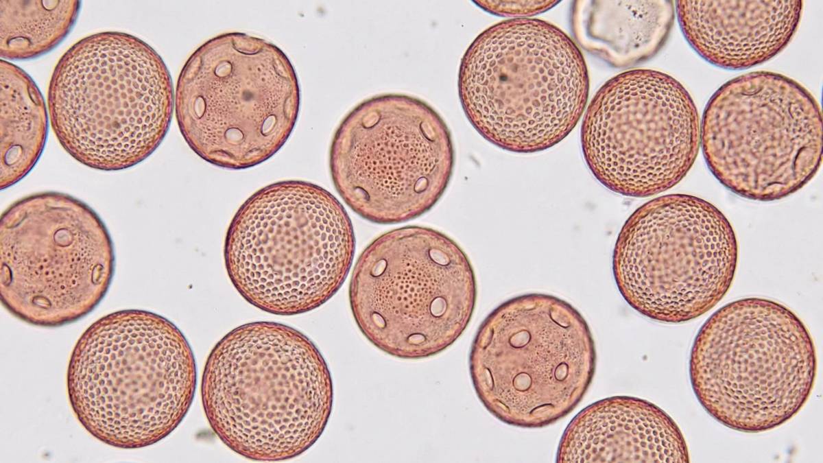 Ziarna pyłku leszczyny pod mikroskopem. Fot. Pixabay.