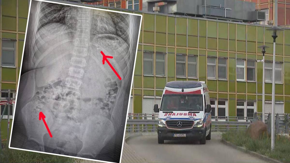 11-latek w ramach wyzwania połknął kilka petard. Matka wyjaśnia