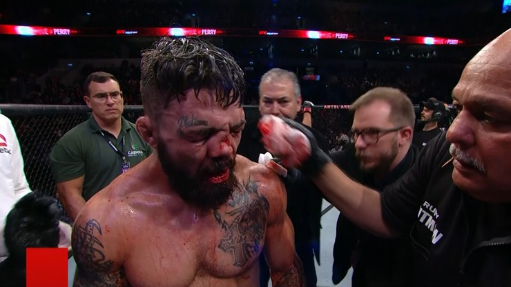 UFC w Montevideo: Nos przestawiony o kilka centymetrów! Oktagon zalał się krwią (WIDEO)
