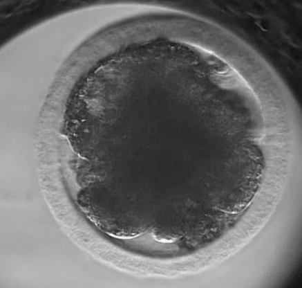 Zarodek żubra - Zdjęcie spod mikroskopu