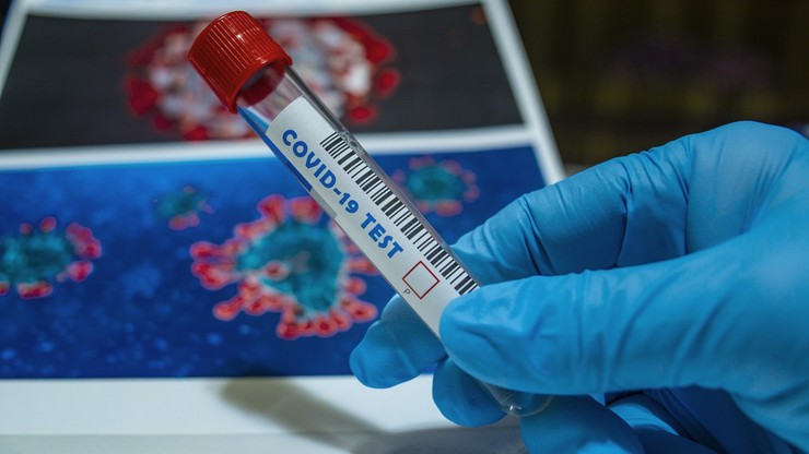 Szwajcaria: już 28 przypadków zakażenia brytyjską mutacją koronawirusa