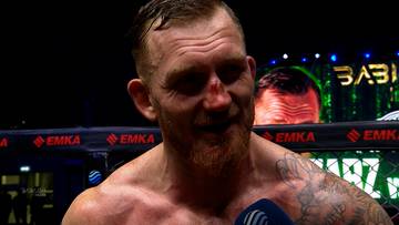 Mężczyzna z urazem nosa, prawdopodobnie po walce.