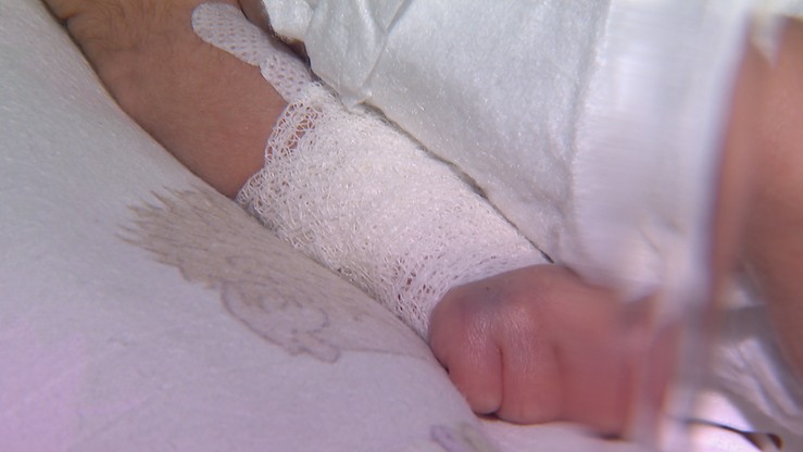 4-miesięczny chłopiec z urazem ręki trafił do szpitala. Rodzice podejrzani o znęcanie