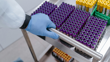 Coraz więcej ofiar epidemii. "Kontakty wysokiego ryzyka" w drodze do Europy