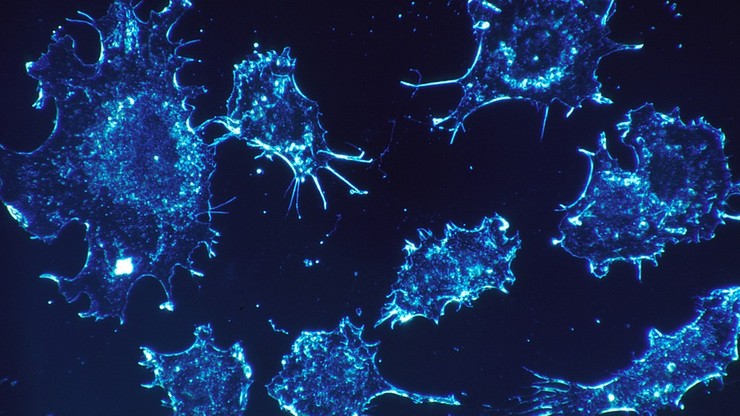 "Piękno polega na tym, że niszczymy tylko komórki zwyrodniałe". Łódzcy naukowcy opracowali metodę walki z nowotworem