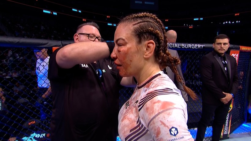 UFC: Miesha Tate pokazała twarz po walce. "Niektóre kobiety wiele płacą za takie usta"