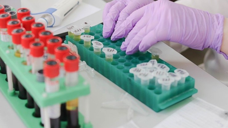 Gdańscy naukowcy pracują nad testem na koronawirusa. Może być tańszy od obecnie wykonywanego