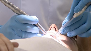 Drożej u stomatologa. Pytamy dentystów o "paragony grozy"