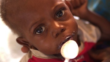 7,5 mln dzieci umiera z głodu. UNICEF alarmuje