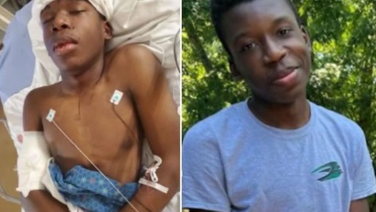 USA. Czarnoskóry nastolatek pomylił domy. Został postrzelony w głowę i walczy o życie