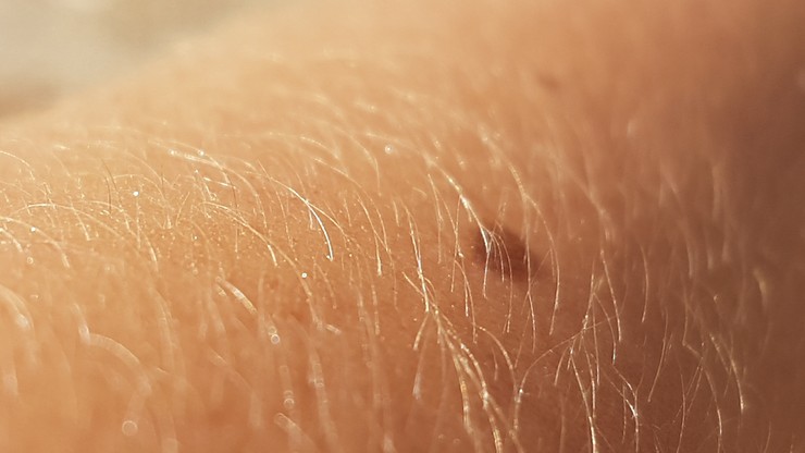 Nowa metoda wykrywania raka skóry może "radykalnie zmienić diagnostykę"