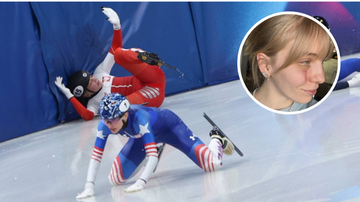 Polka pokazała bliznę po koszmarnym wypadku. "Wciąż czuję się sobą"