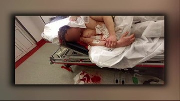 Ratownik medyczny zaatakowany siekierą. 47-latek odniósł poważne obrażenia