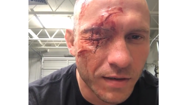 Zawodnik UFC "zmasakrował" sobie twarz