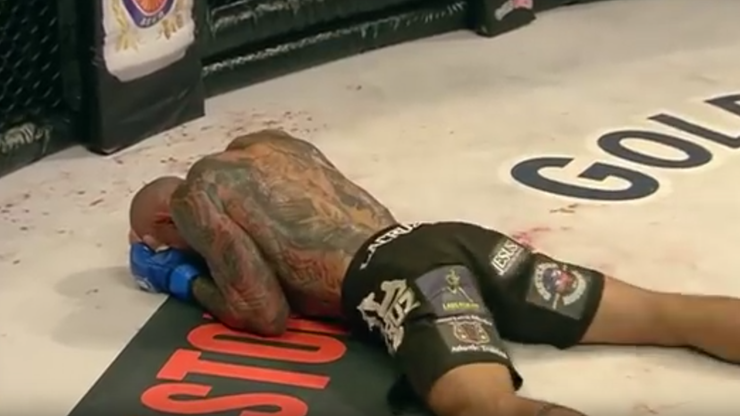 Brazylijski zawodnik MMA już po operacji pękniętej czaszki. "Będę dosłownie cyborgiem"