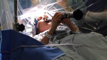 Operowali jej mózg. Pacjentka grała w tym czasie na klarnecie