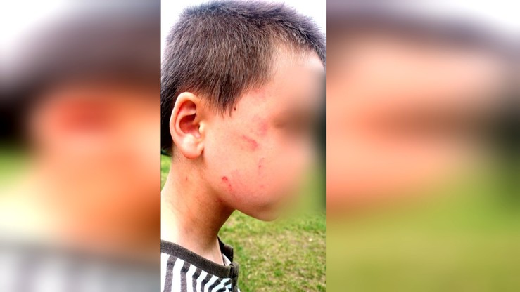 "Interwencja": wychowawczyni uderzyła 7-latka z domu dziecka w twarz i urządziła mu zimny prysznic. Polsat, piątek, godz. 16:15