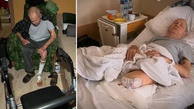 Przez cztery dni nikt nie zajrzał pod opatrunek. Musieli amputować nogę