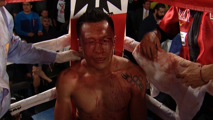 Vargas zdetronizowany! Berchelt wygrał ringową wojnę